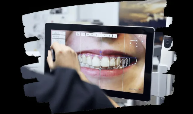 Роль прикуса в формировании улыбки