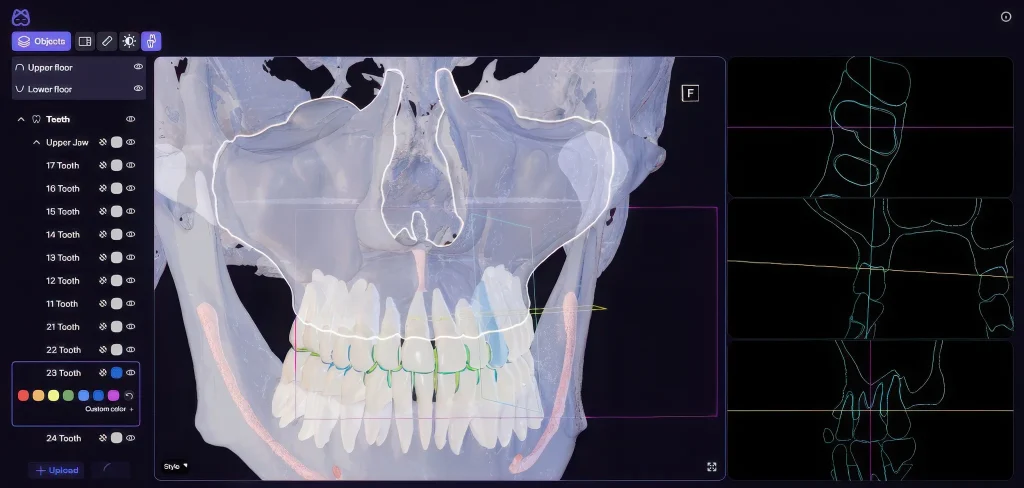 Модель зубочелюстной системы