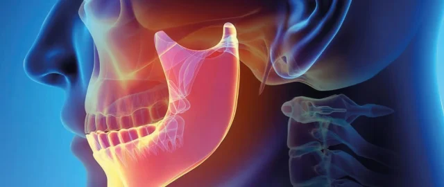 Комплексное лечение челюсти: спокойный план от первого визита до улыбки без боли