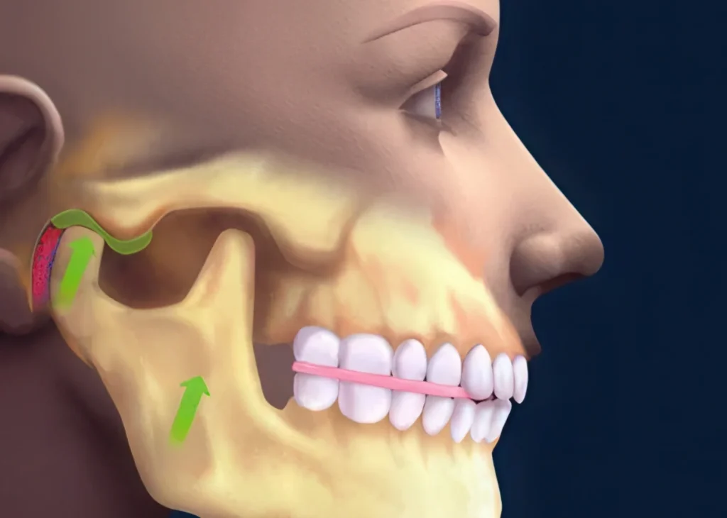 Схема зубов и височно-нижнечелюстного сустава