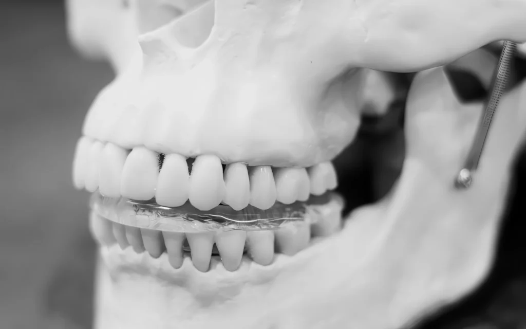 прикусная индивидуальная шина