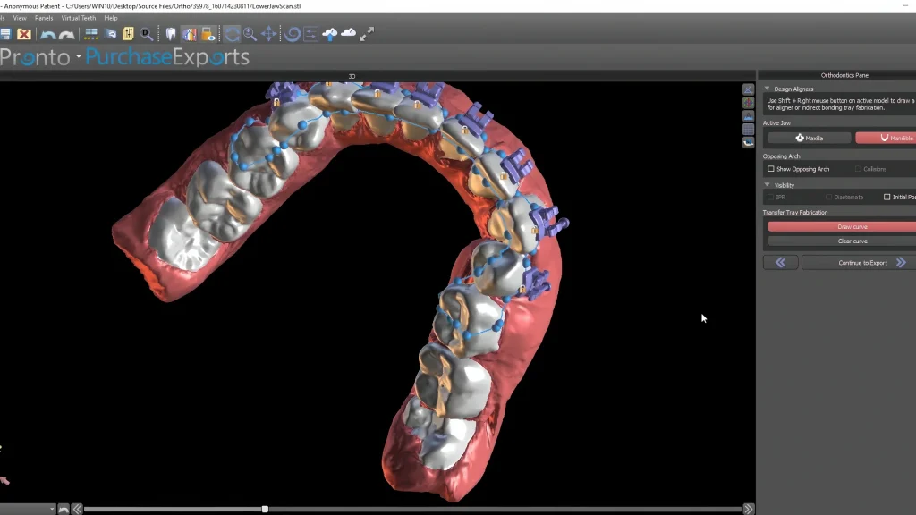 3D-диагностика в ортодонтии