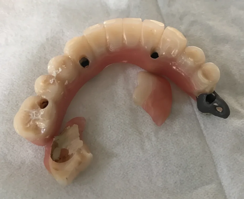 поломка временного протеза