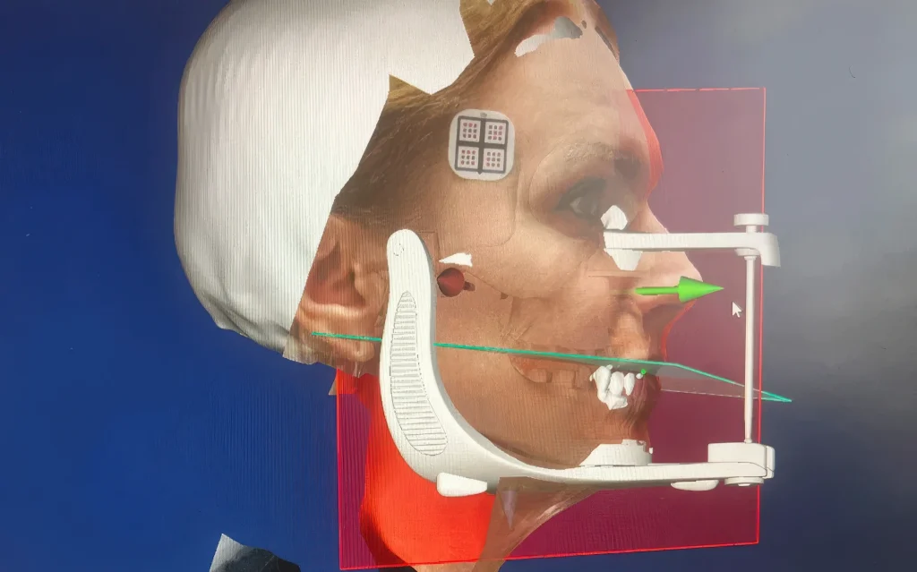 3D измерения челюсти