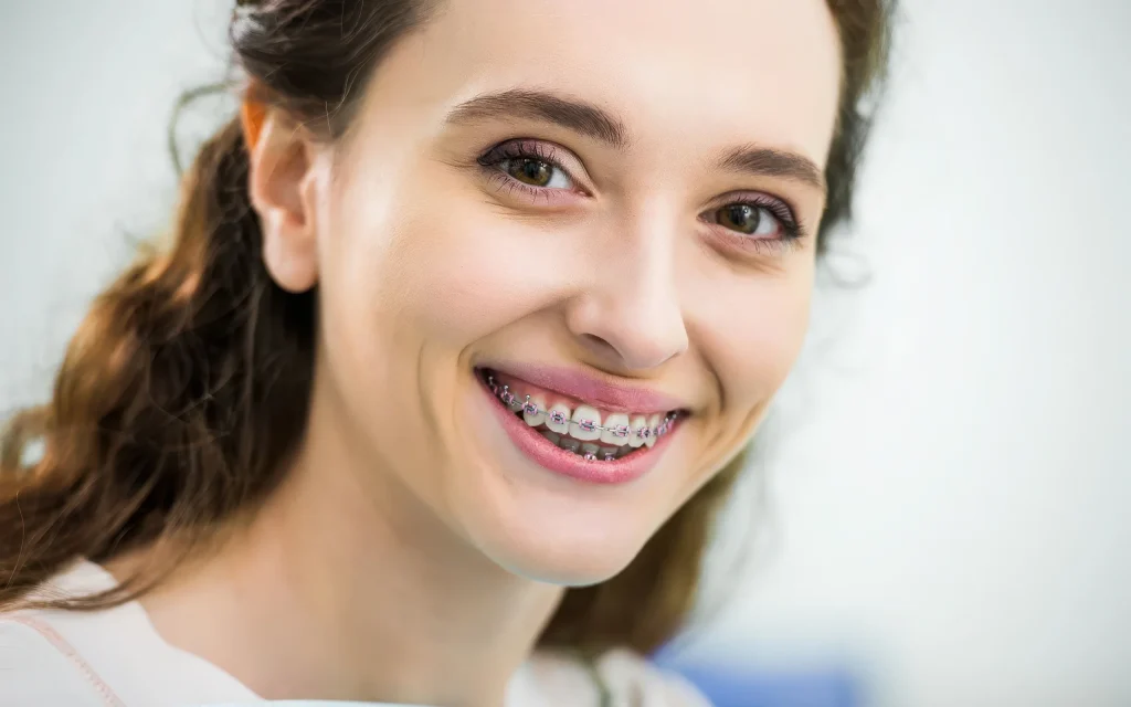 Лечение брекетами