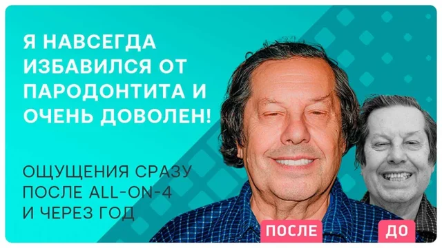Имплантация всех зубов all-on-4