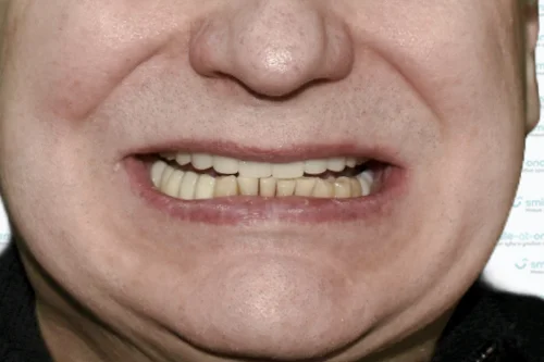 До — 