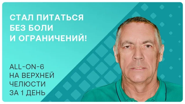 Имплантация all-on-6 за 1 день