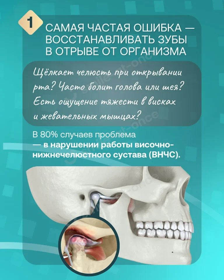 Галерея - Что скрывается за идеальной улыбкой: почему нельзя игнорировать ВНЧС - Слайд 2