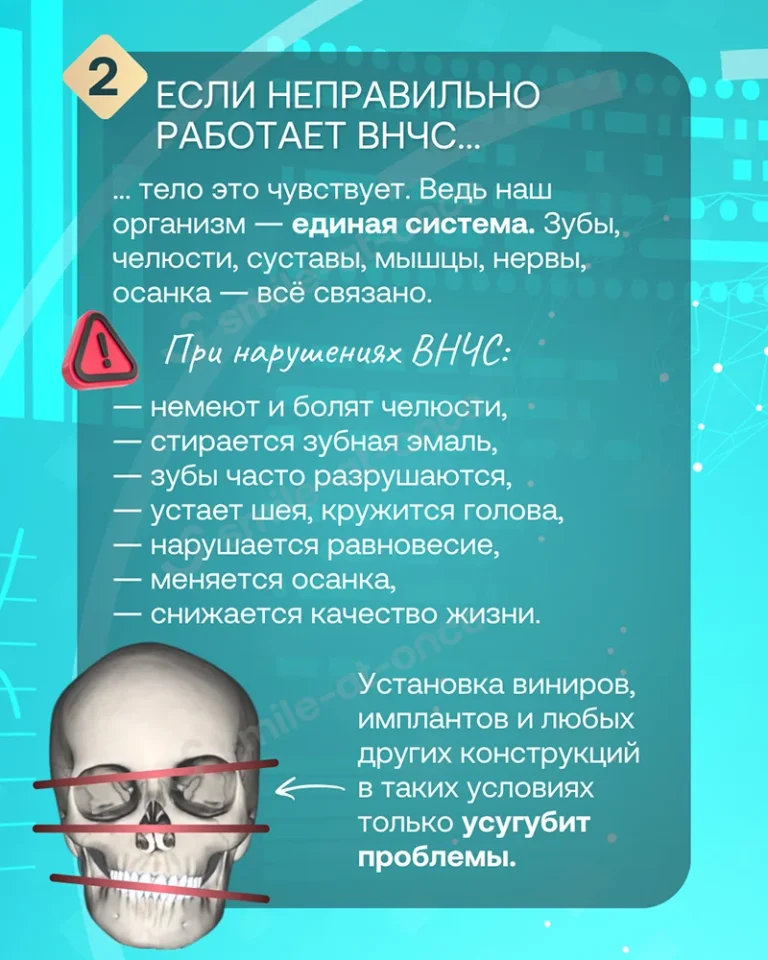 Галерея - Что скрывается за идеальной улыбкой: почему нельзя игнорировать ВНЧС - Слайд 3