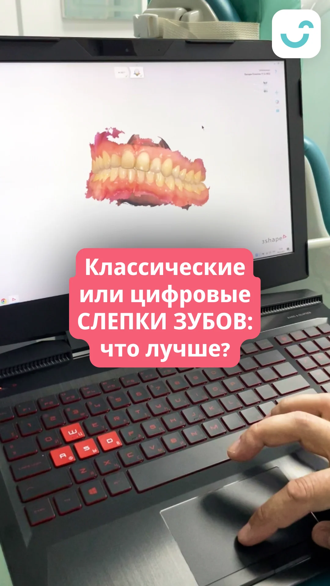 Видео о создании цифровых слепков зубов